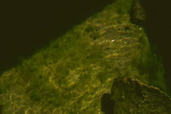 Aspergillus Penicillioides
