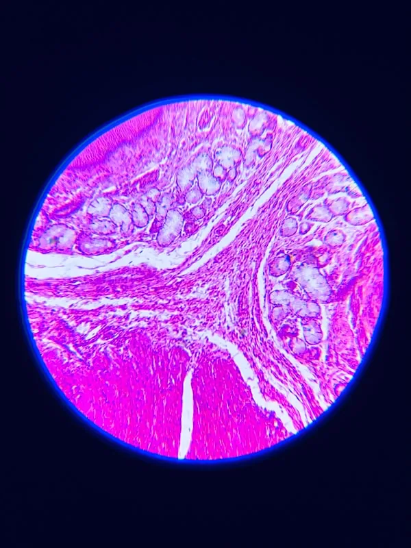Aspergillus Versicolor